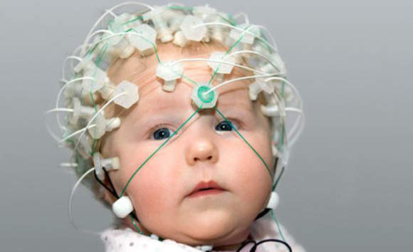 Электроэнцефалография ребенку