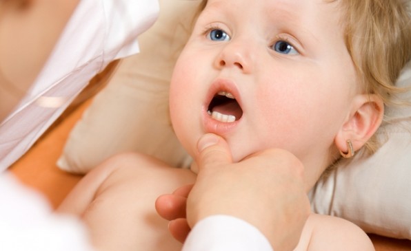 Молочница у детей — особенности лечения для разных возрастов