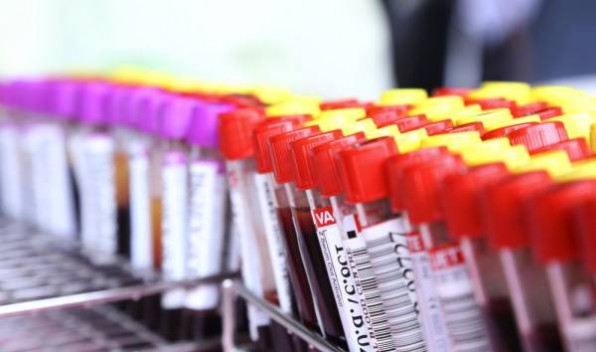 Биохимический анализ крови у детей, нормы и расшифровка