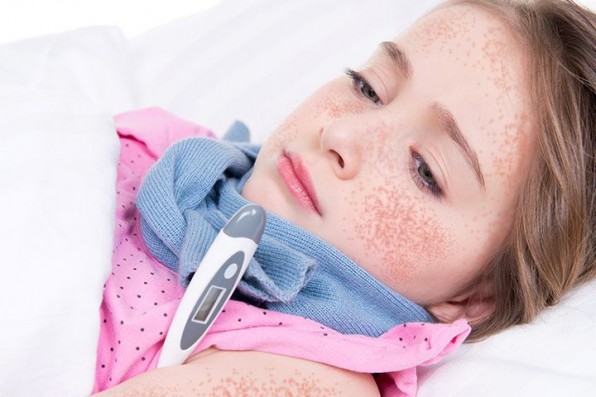 Лихорадка у детей: виды и лечение