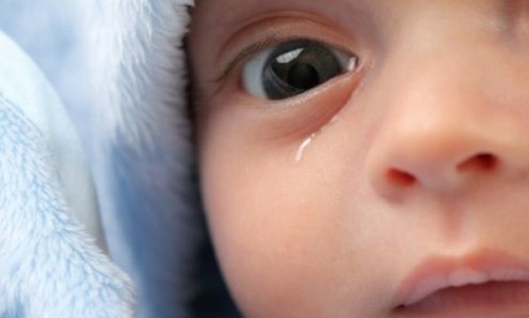 Дакриоцистит новорожденных и грудничков, почему у ребенка слезятся глазки